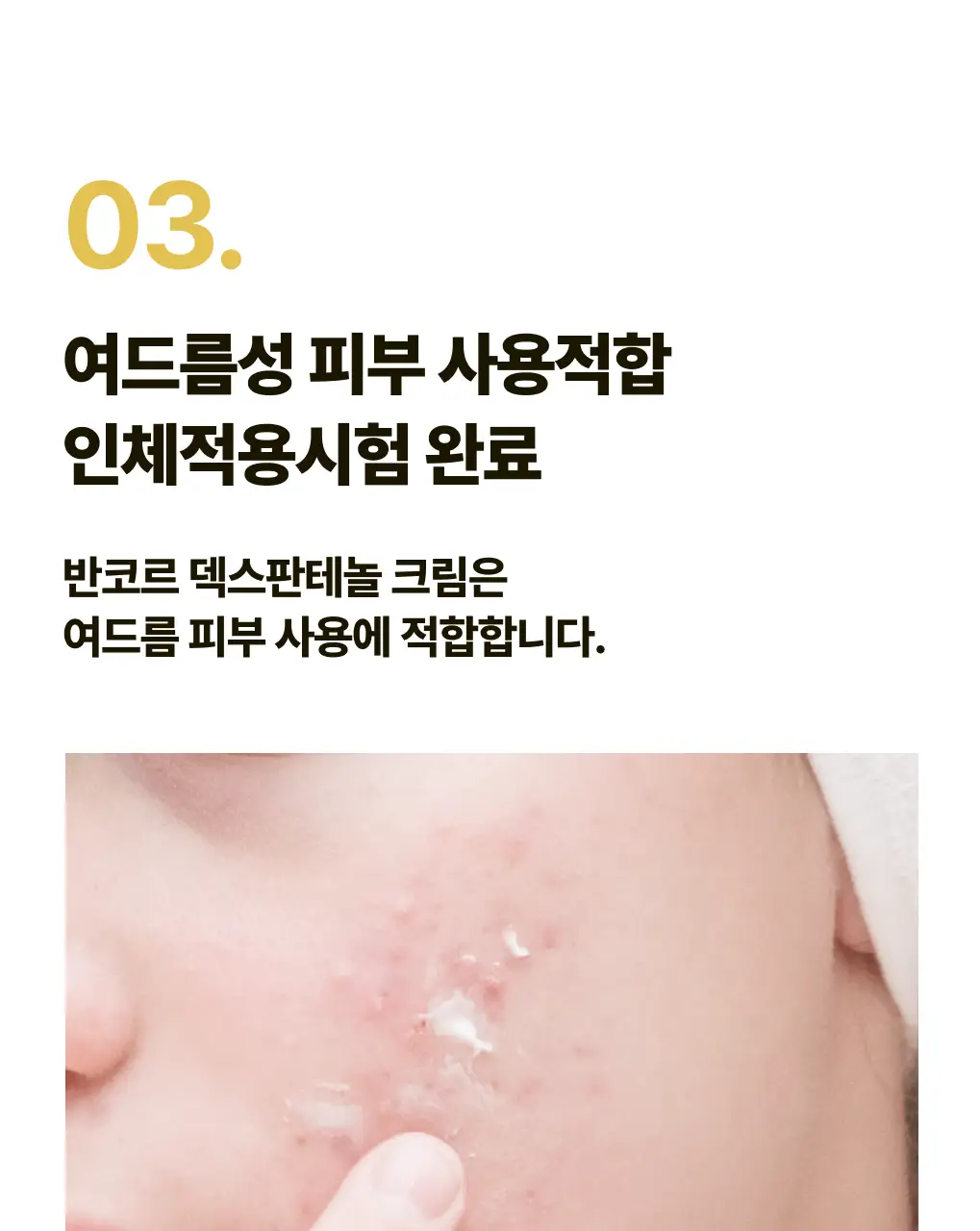 [색소침착 진정크림] 덱스판테놀17만ppm 장벽크림 상세페이지 8